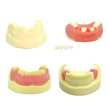 Модель зубных имплантатов, демонстрационная модель стоматолога, стоматологический инструмент, Стоматологические материалы